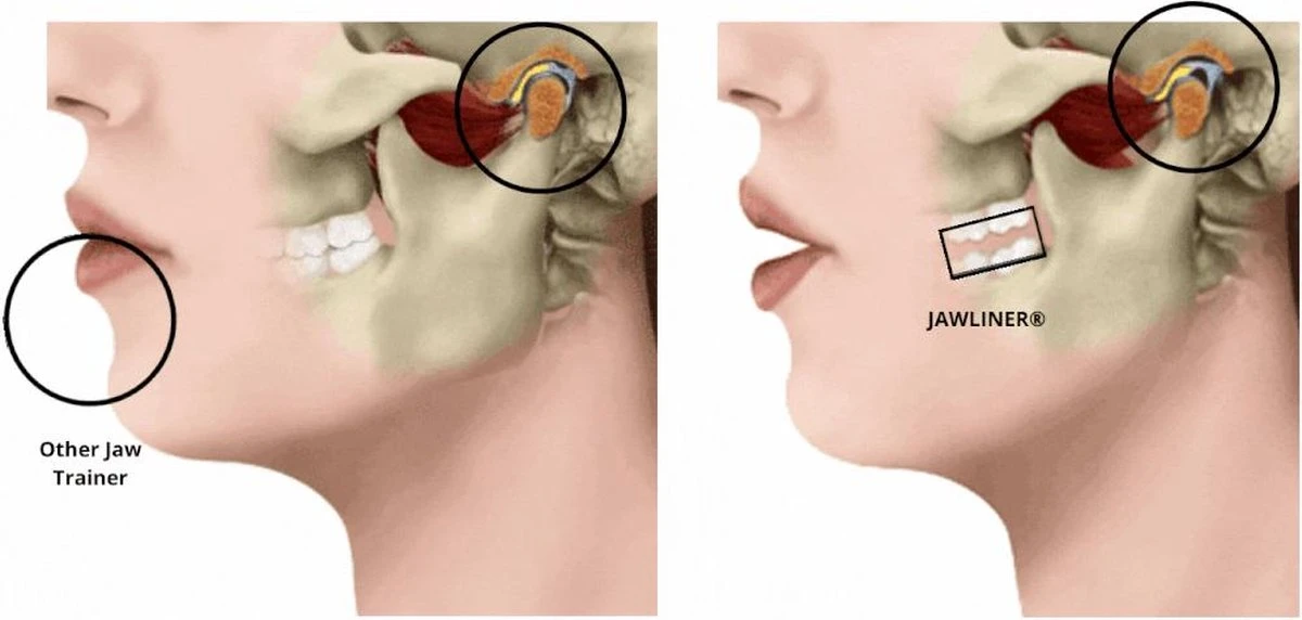 Kaaklijn Jawline Trainer Sport Fitness Kaak Trainer Gym Jawliner - Variant Advanced - Kaaklijn Onderkin Gezichtstrainer - Jawliner® 9 Kaaklijn Jawline Trainer Sport Fitness Kaak Trainer Gym Jawliner - Variant Advanced - Kaaklijn Onderkin Gezichtstrainer - Jawliner® - Afbeelding 7